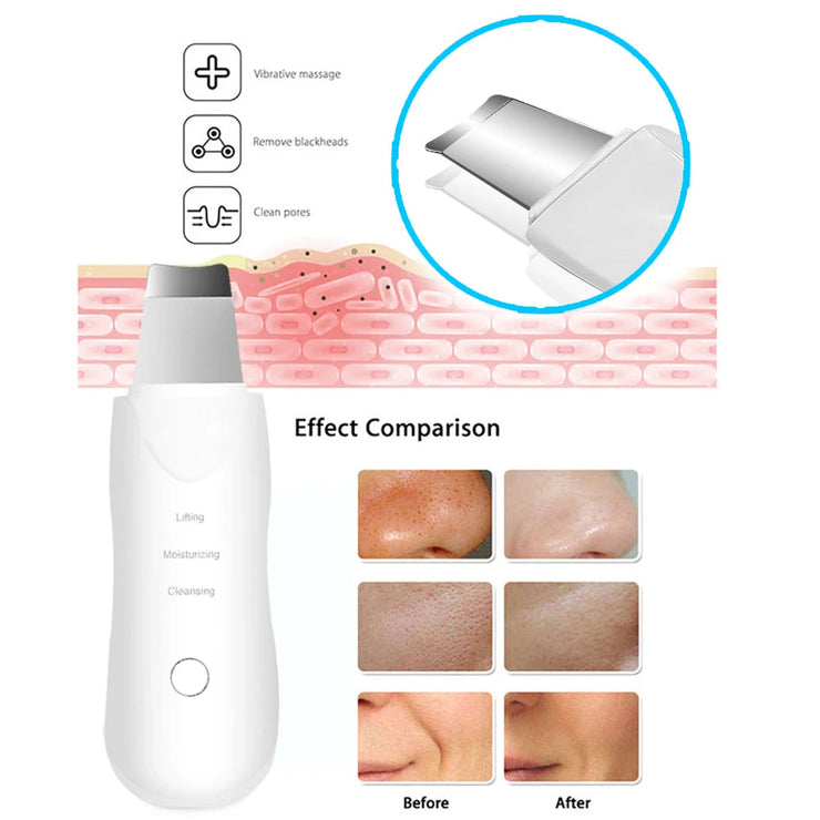 Ultrasonic Skin Scrubber Scrubber Deep Vibrate Facial Cleaner Shovel Face Scrubber Peeling Black Head Remover Facial Massager JONNY