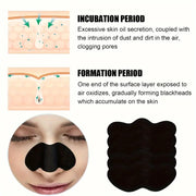 10/50/100 Pieces Blackhead Remover Patches Deep Cleansing - Effective Facial Cleansing to Absorb Facial Blackheads and Pores JONNY