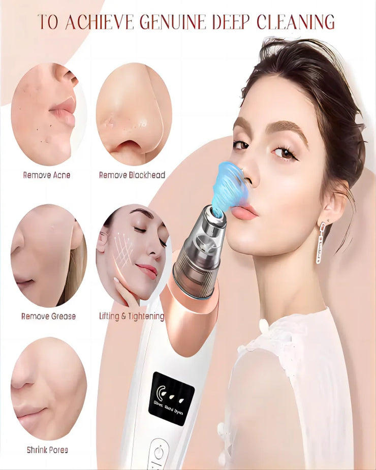 Newest Technology Blackhead Remover Vacuum Pore Cleaner for Face&Nose Blackhead Removal Kit Electric Acne Facial Extractor Tool