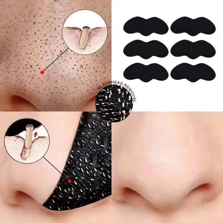 10/50/100 Pieces Blackhead Remover Patches Deep Cleansing - Effective Facial Cleansing to Absorb Facial Blackheads and Pores JONNY